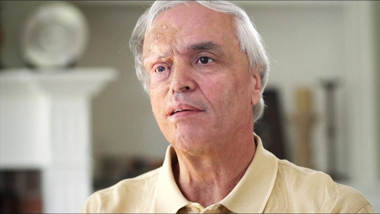 سقط هذا الرجل في حادث تحطم طائرة مميت ليعود ليحكي