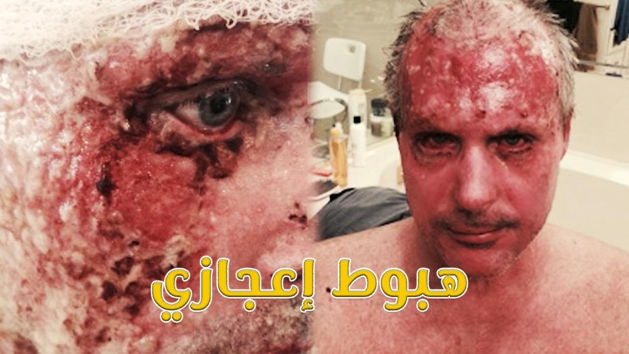 ناجي من حادث طائرة مميت